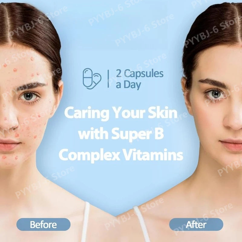 Vitamin B Complex Plus13-in-1 120Vegan Capsules Energy Support Immune Health Nerve Function Skin Wellness Antioxidant Supplement