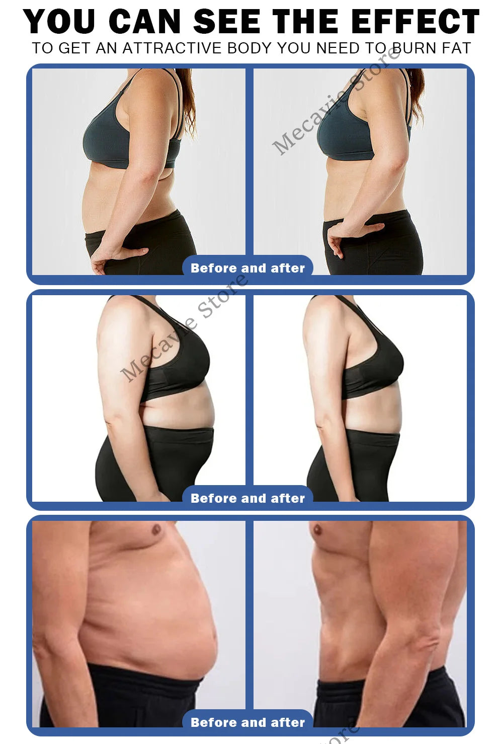 EMSZERO Portable Ems Machines Full Body Sculpting Device MuscleStimulator Slimming Professional Zero RF NEO NOVA Shaping